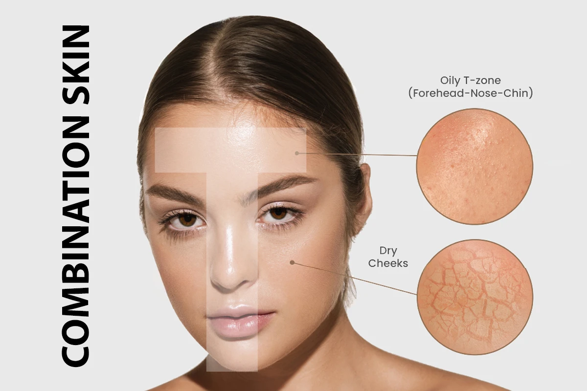 روتین پوست مختلط چیست؟